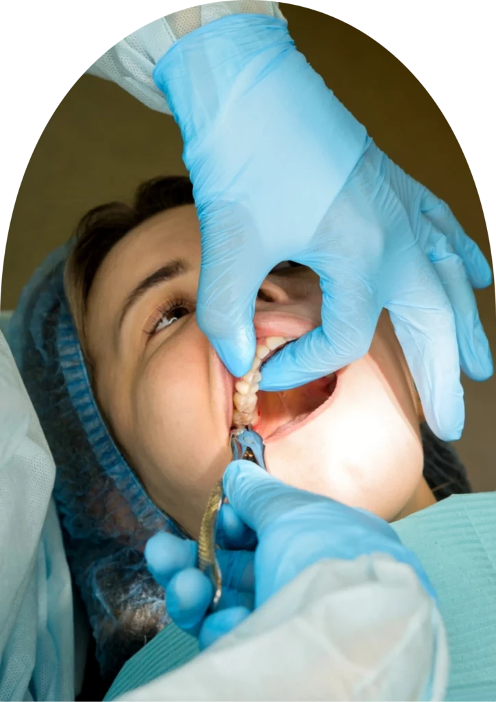A beyondental dentist is extracting the patient's wisdom tooth